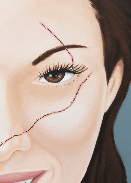From the other side