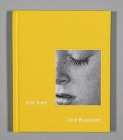 Milk Teeth